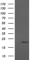 ANAPC11 Antibody in Western Blot (WB)