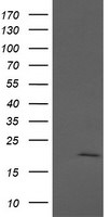 ANAPC11 Antibody in Western Blot (WB)