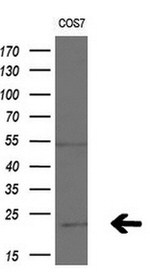 ANAPC11 Antibody in Western Blot (WB)