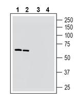 Nicotinic Acetylcholine Receptor alpha 6 (CHRNA6) (extracellular) Polyclonal Antibody