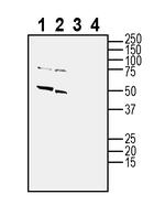 Nicotinic Acetylcholine Receptor alpha 7 (CHRNA7) (extracellular) Antibody in Western Blot (WB)