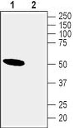 Nicotinic Acetylcholine Receptor alpha 10 (CHRNA10) Antibody in Western Blot (WB)