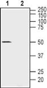 Nicotinic Acetylcholine Receptor alpha 10 (CHRNA10) Antibody in Western Blot (WB)