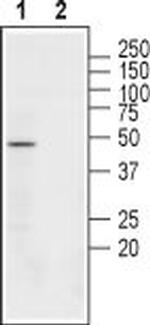 Nicotinic Acetylcholine Receptor beta 3 (CHRNB3) (extracellular) Antibody in Western Blot (WB)