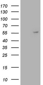 ANGPT1 Antibody in Western Blot (WB)