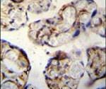 ANGPTL1 Antibody in Immunohistochemistry (IHC)