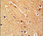 ANKFY1 Antibody in Immunohistochemistry (IHC)