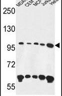 ANKFY1 Antibody in Western Blot (WB)