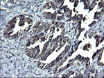 ANKMY2 Antibody in Immunohistochemistry (Paraffin) (IHC (P))