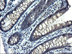 ANKMY2 Antibody in Immunohistochemistry (Paraffin) (IHC (P))