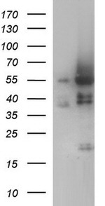 ANKMY2 Antibody in Western Blot (WB)