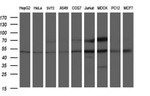 ANKMY2 Antibody in Western Blot (WB)