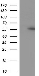 ANKMY2 Antibody in Western Blot (WB)