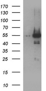 ANKMY2 Antibody in Western Blot (WB)
