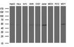 ANKMY2 Antibody in Western Blot (WB)