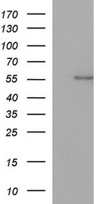ANKMY2 Antibody in Western Blot (WB)