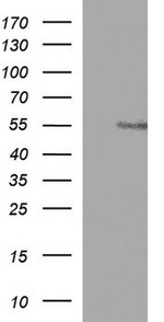 ANKMY2 Antibody in Western Blot (WB)