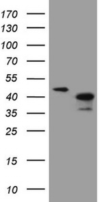 ANKRA2 Antibody in Western Blot (WB)