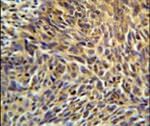 ANKRD32 Antibody in Immunohistochemistry (IHC)