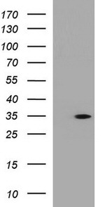 ANKRD49 Antibody in Western Blot (WB)