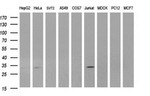 ANKRD49 Antibody in Western Blot (WB)