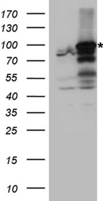 ANKRD52 Antibody in Western Blot (WB)