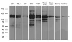 ANKRD52 Antibody in Western Blot (WB)