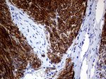 ANO1 Antibody in Immunohistochemistry (Paraffin) (IHC (P))