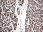 ANO1 Antibody in Immunohistochemistry (Paraffin) (IHC (P))