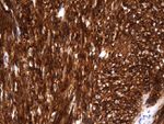 ANO1 Antibody in Immunohistochemistry (Paraffin) (IHC (P))