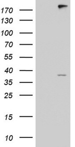 ANO1 Antibody in Western Blot (WB)