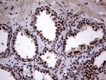 ANP32C Antibody in Immunohistochemistry (Paraffin) (IHC (P))