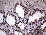 ANP32C Antibody in Immunohistochemistry (Paraffin) (IHC (P))