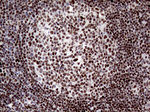 ANP32C Antibody in Immunohistochemistry (Paraffin) (IHC (P))