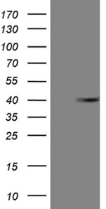 ANP32C Antibody in Western Blot (WB)