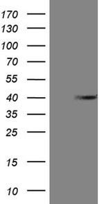 ANP32C Antibody in Western Blot (WB)