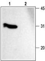 SNAP-25 Polyclonal Antibody