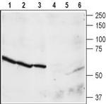 NPY4R Antibody in Western Blot (WB)