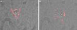CD56/NCAM1 (extracellular) Polyclonal Antibody