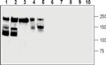 CD56/NCAM1 (extracellular) Antibody in Western Blot (WB)