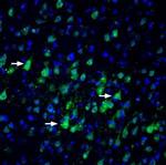 Nectin-3/PVRL3 (extracellular) Polyclonal Antibody