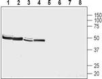 NMUR2 (extracellular) Antibody in Western Blot (WB)