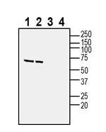 NPBWR1 Antibody in Western Blot (WB)