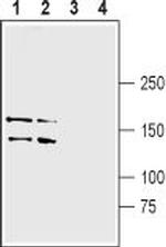 LRRK1 Polyclonal Antibody