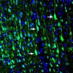 LRRTM1 (extracellular) Polyclonal Antibody