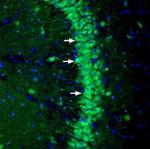 NGL-3/LRRC4B (extracellular) Polyclonal Antibody