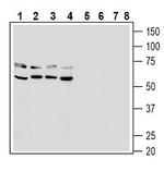 RAGE (extracellular) Polyclonal Antibody