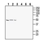 TMEM106B (extracellular) Antibody in Western Blot (WB)