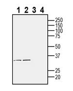 TMEM106B (extracellular) Antibody in Western Blot (WB)