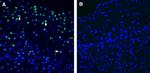 Neuronal Pentraxin 2 (NPTX2) Antibody in Immunohistochemistry (Frozen) (IHC (F))